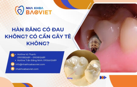 Hàn răng có đau không? Có cần gây tê không?