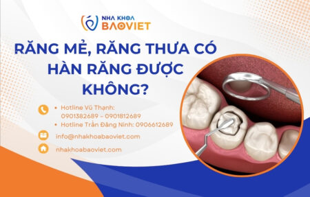 Răng mẻ, răng thưa có hàn răng được không?