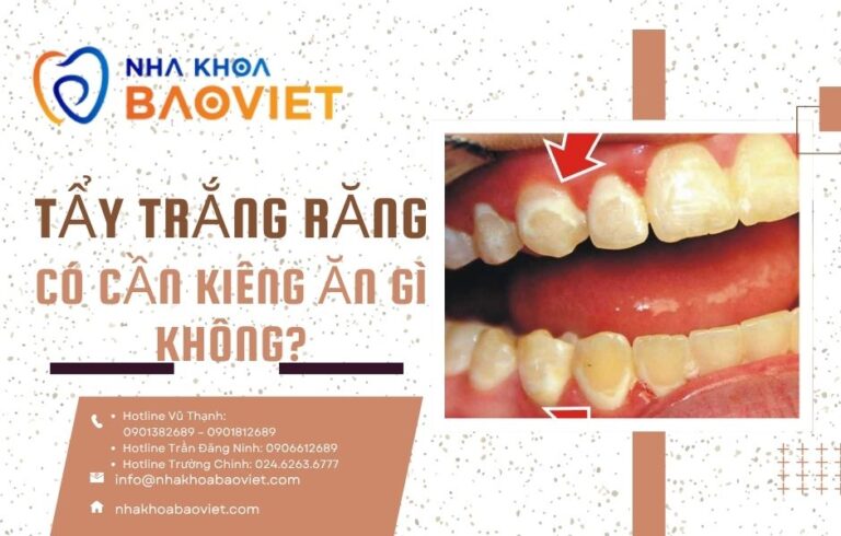 nha khoa bao viet template 940 x 600 px 1 2