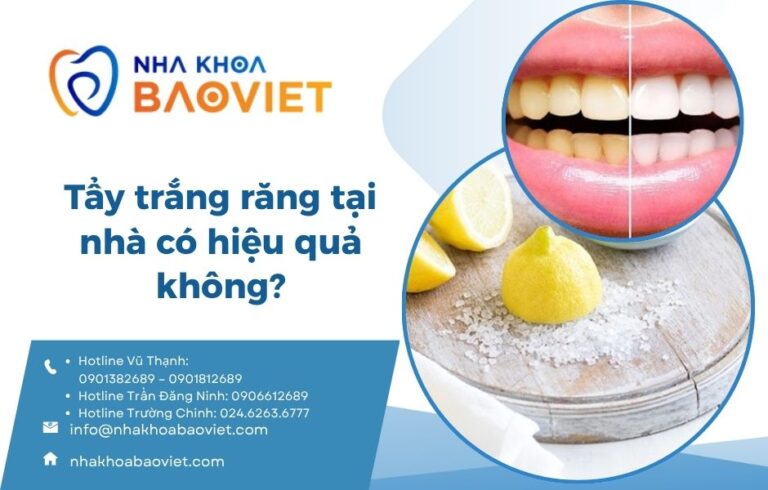 Tẩy trắng răng tại nhà có hiệu quả không?