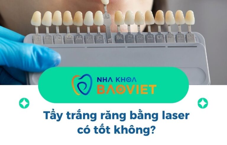 Tẩy trắng răng bằng laser có tốt không?
