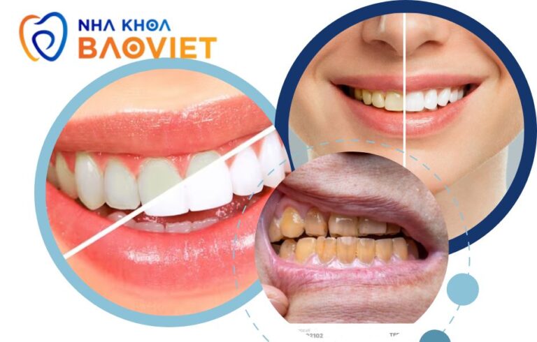 nha khoa bao viet template 940 x 600 px 4 3