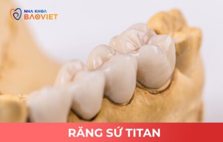 Răng sứ Zirconia hay Titan trên Implant
