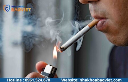 Trồng Implant Có Ảnh Hưởng Sức Khỏe Lâu Dài Không?