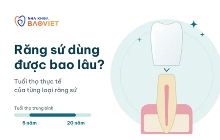 rang su dung duoc bao lau
